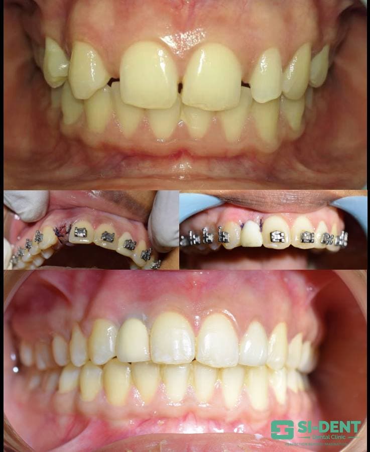 Dental Case 16