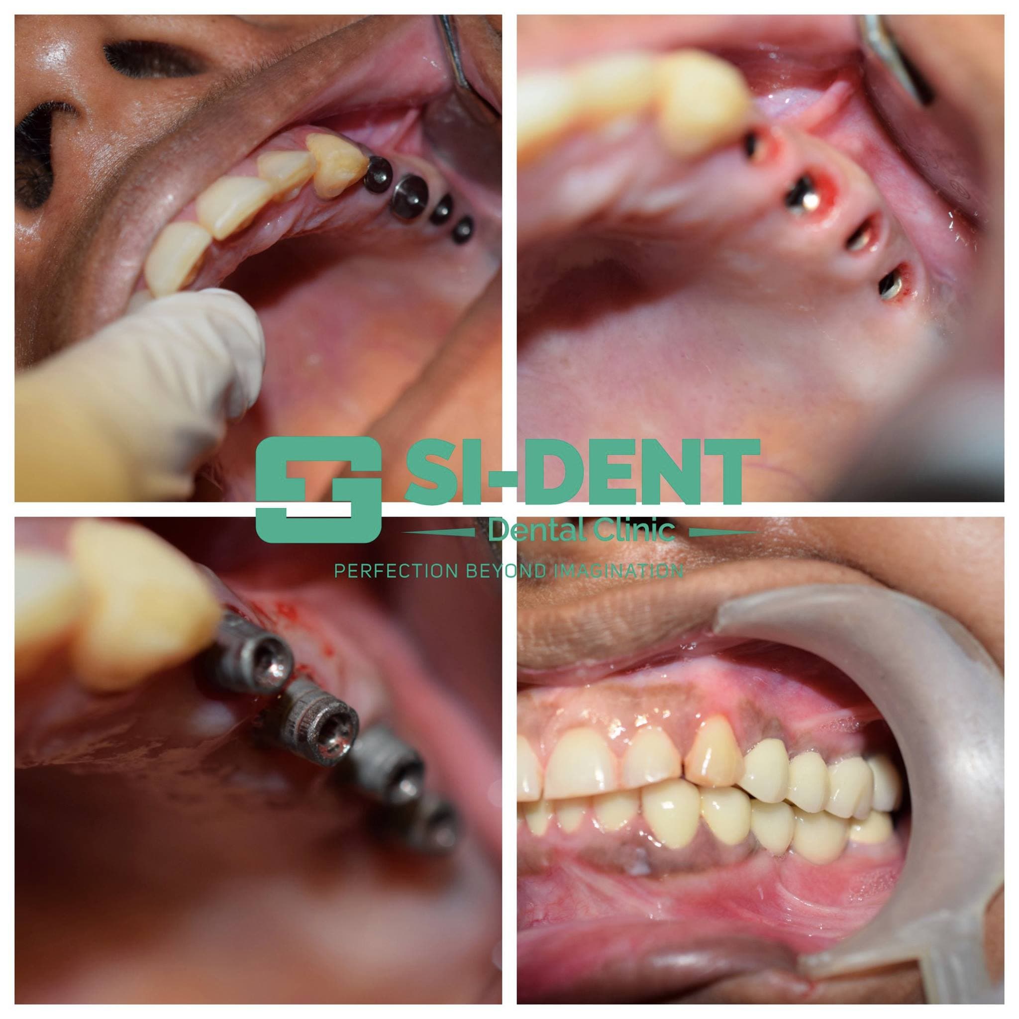 Dental Case 17