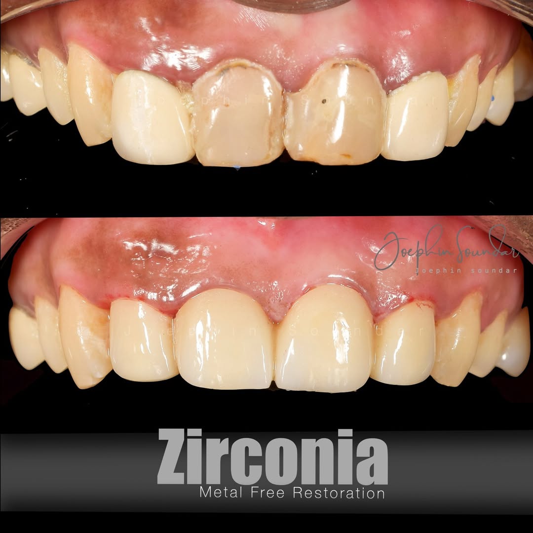 Dental Case 3
