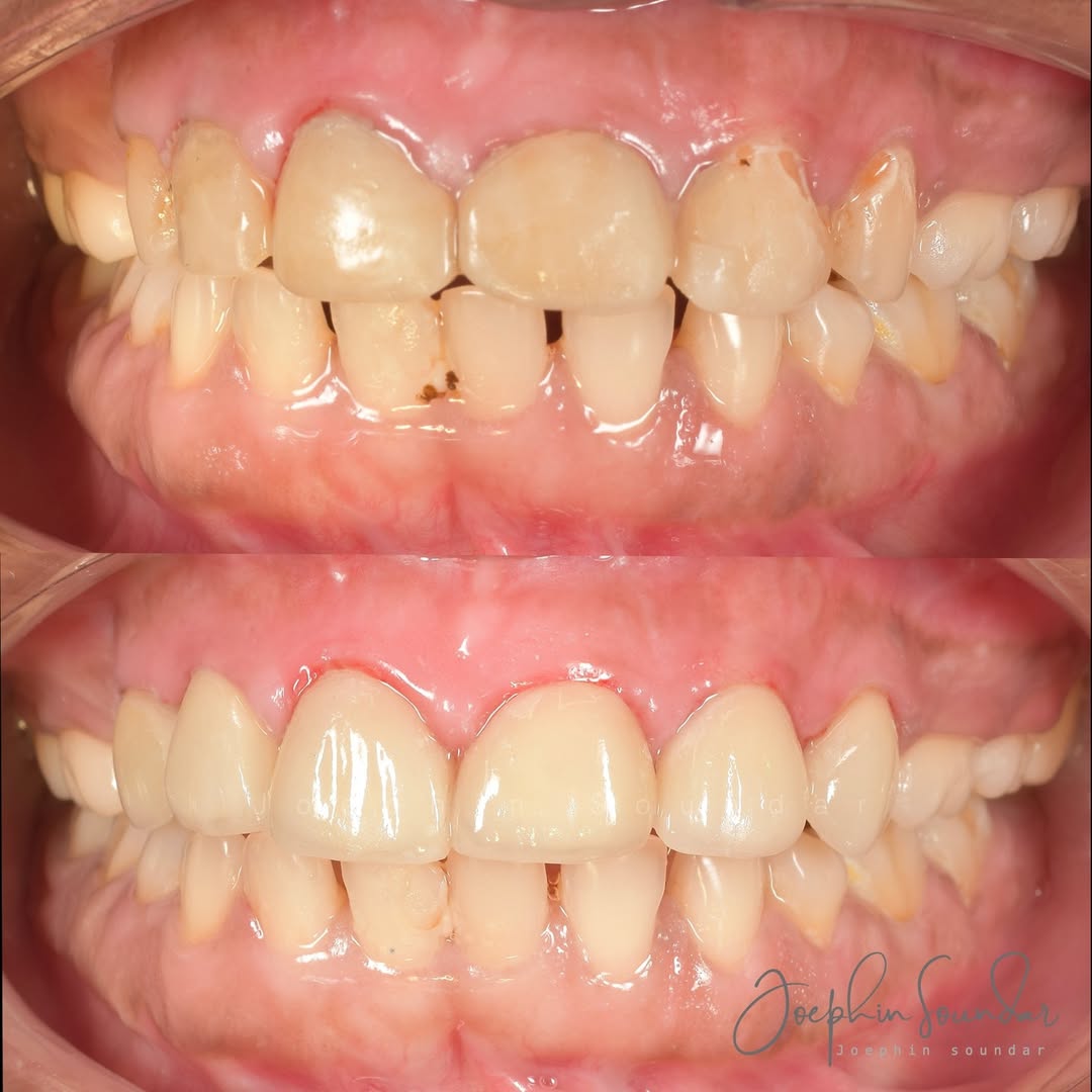 Dental Case 4