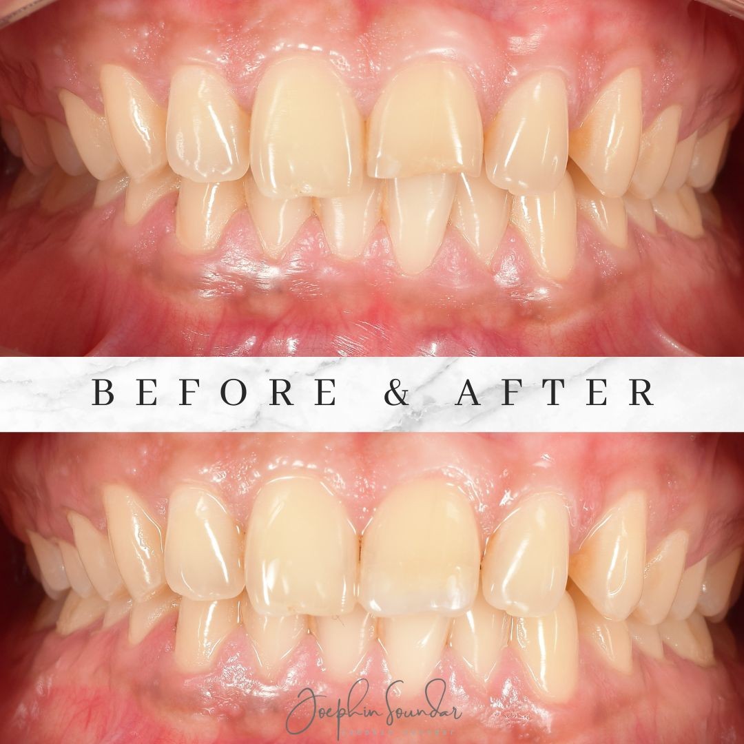 Dental Case 7