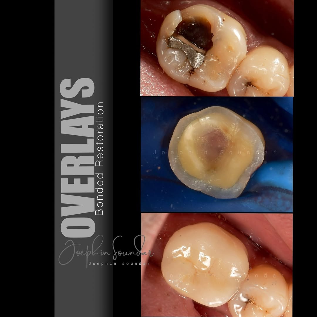 Dental Case 8