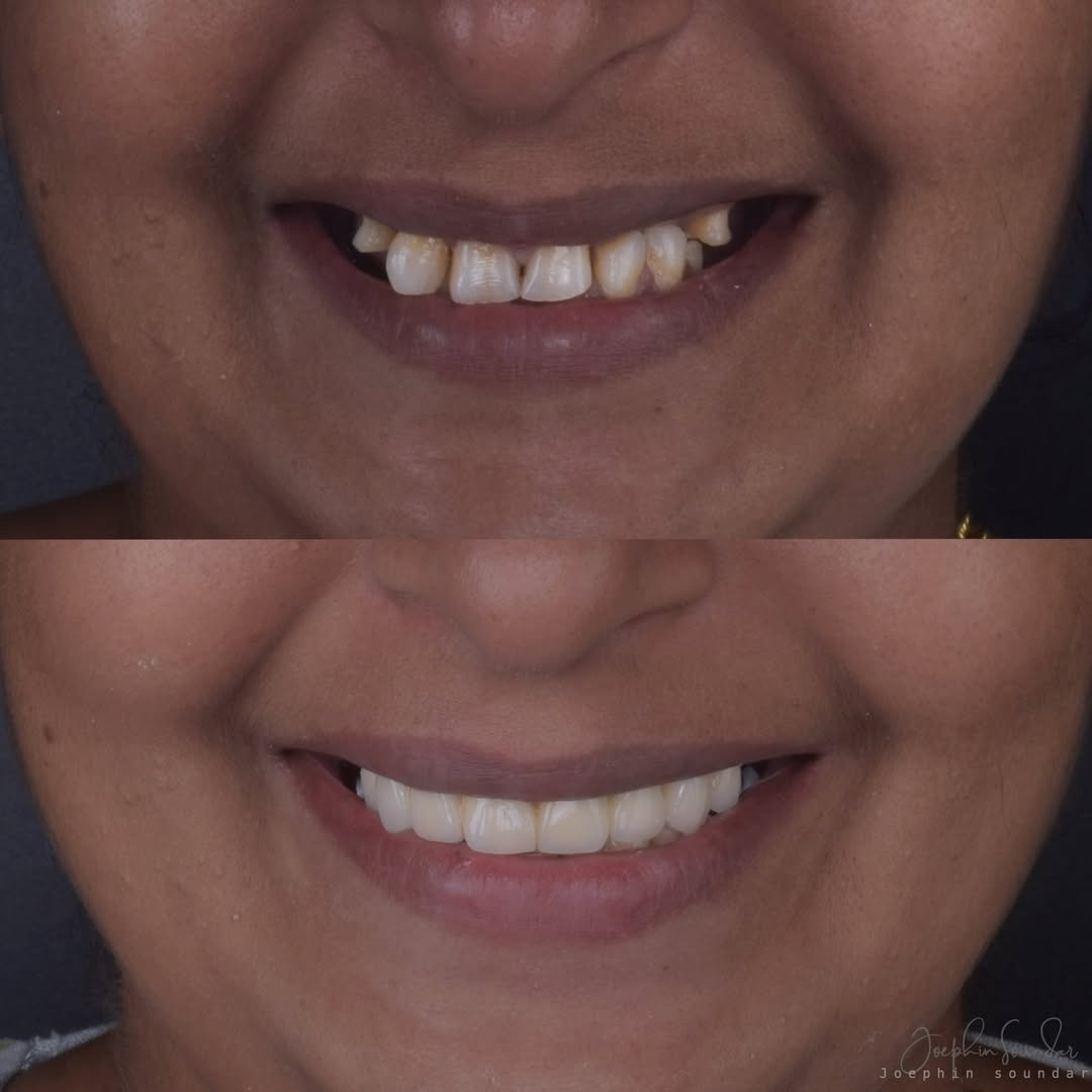 Dental Case 9