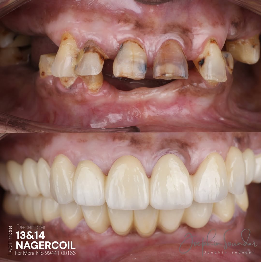 Dental Case 12