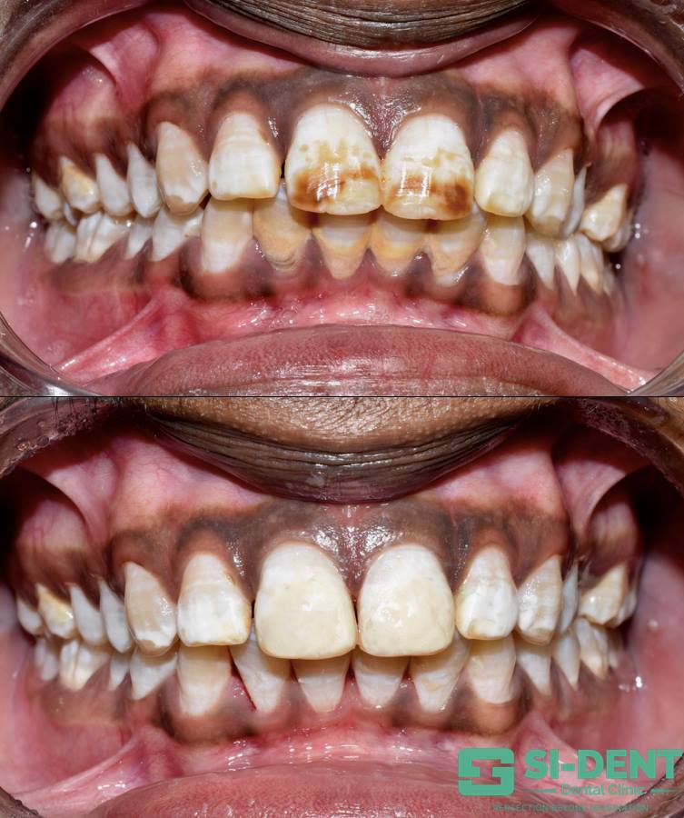 Dental Case 15