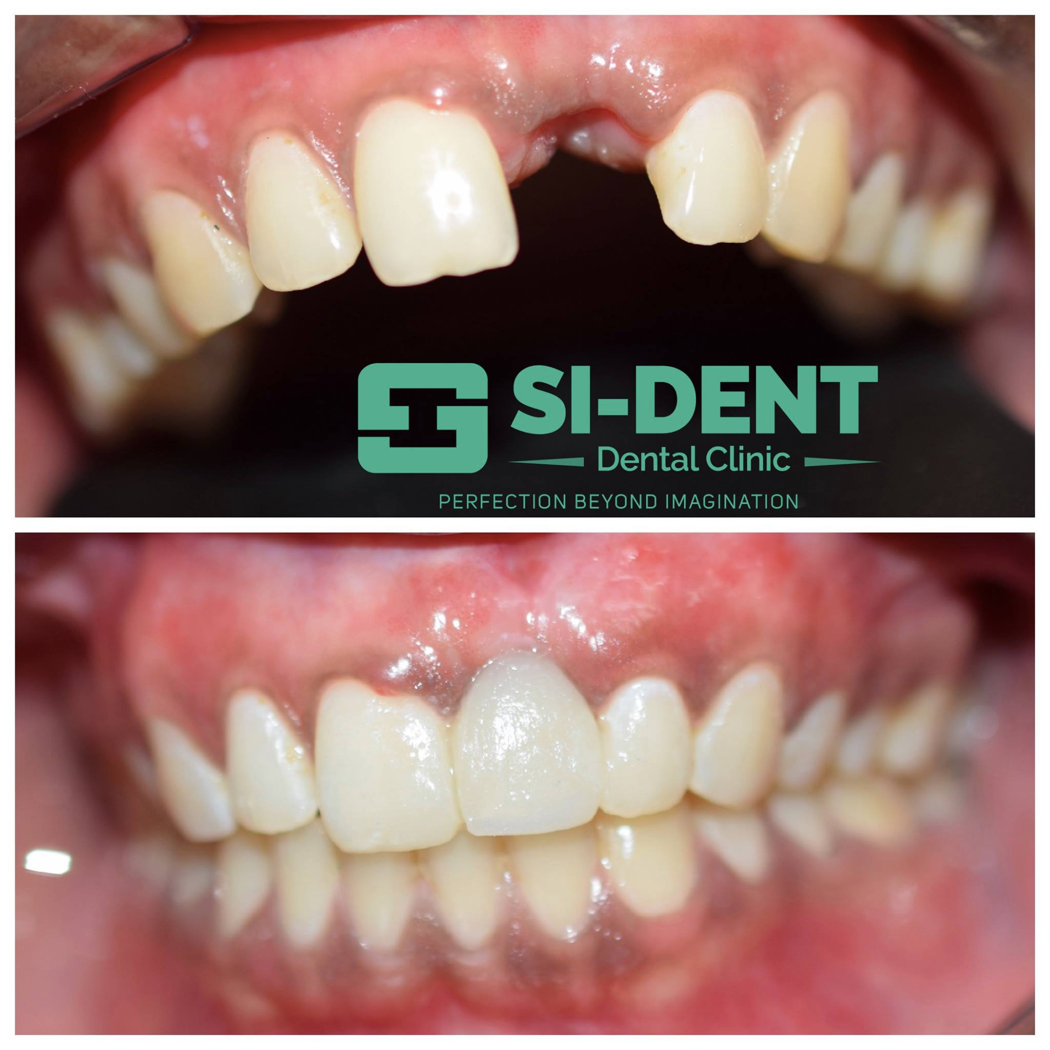 Dental Case 18