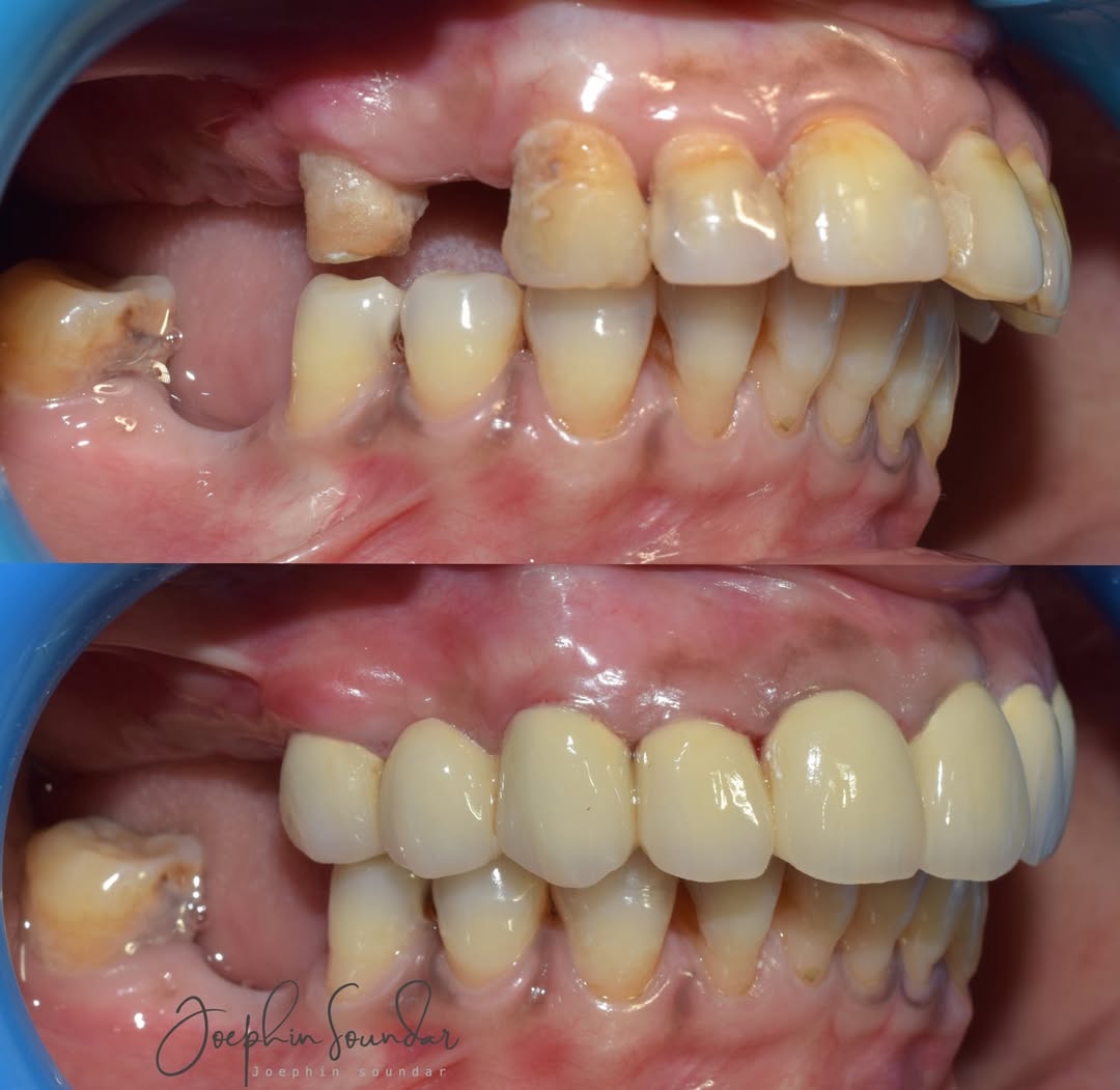Dental Case 20